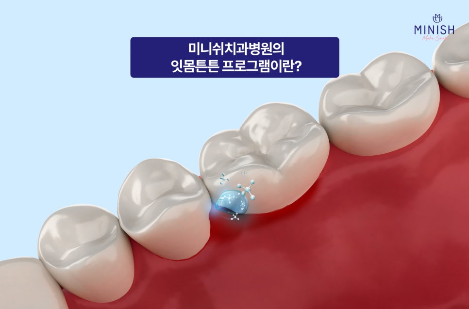Customized Solutions for Different Dental Concerns: What Oral Care Programs Does Minish Dental Hospital Offer? image 4