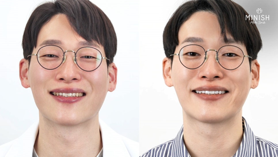 Minish Review by Dentist and Chief Director Kwak Hae-seong: “I Came to Understand the Patient’s Perspective Better” image 7