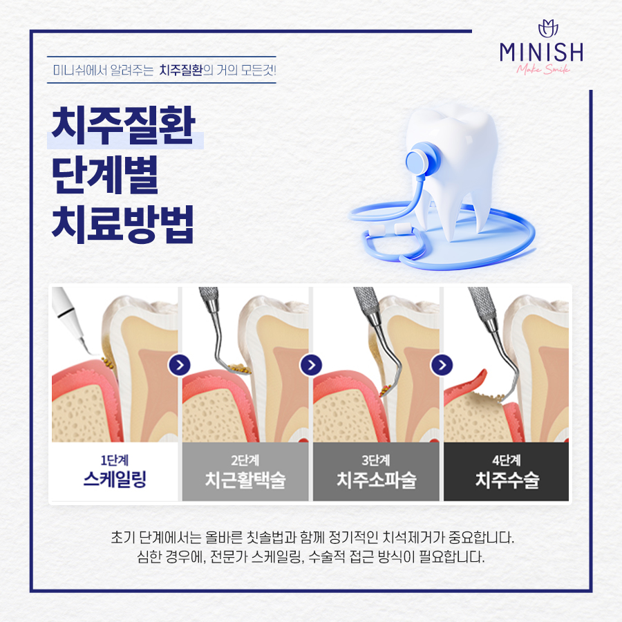 '치주질환'의 거의 모든 것 +잇몸/풍치 자가 체크 관련 이미지 5
