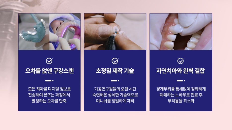 잘못된 크라운! 재치료하다 | 강남구청치과 관련 이미지 12