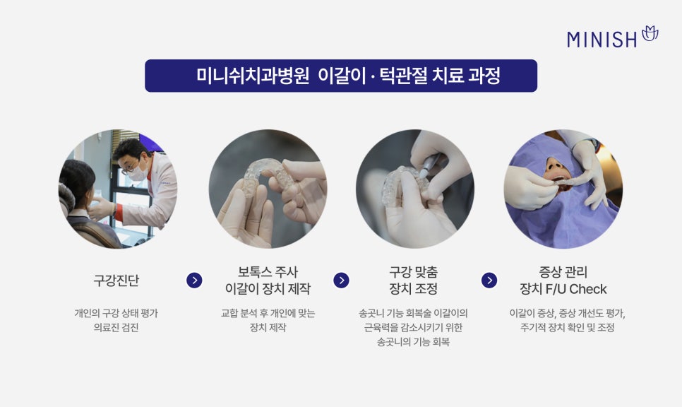 What Matters More Than the Price of a Bruxism Splint for Jaw Sounds: Criteria for Choosing a Temporomandibular Joint Dental Clinic image 6