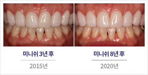 About 관련 이미지 10