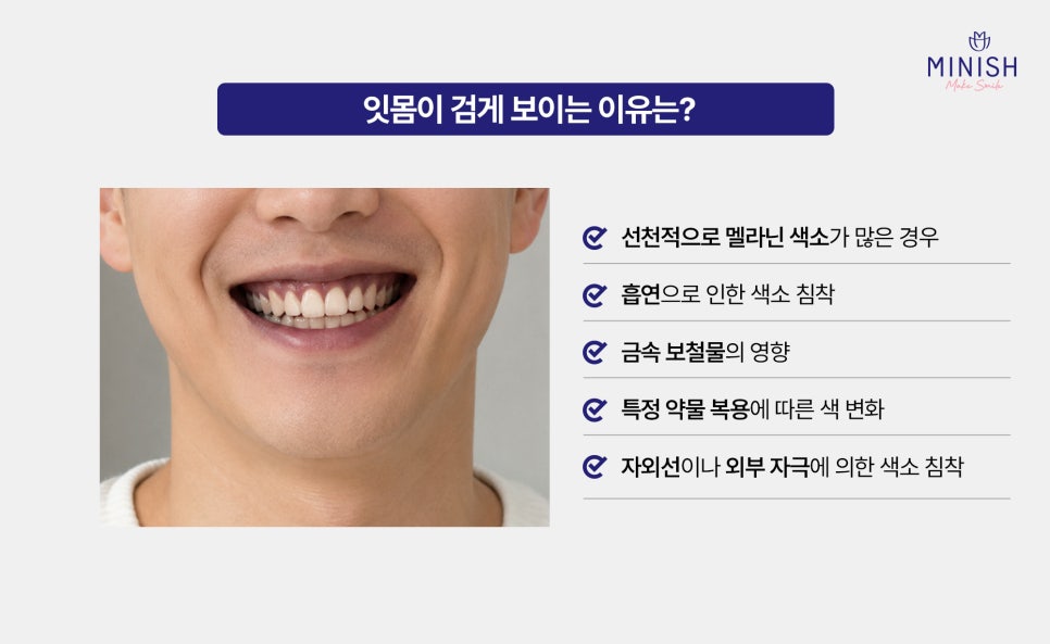 잇몸이 까매요 잇몸미백 필요한 경우 알아보기 관련 이미지 2