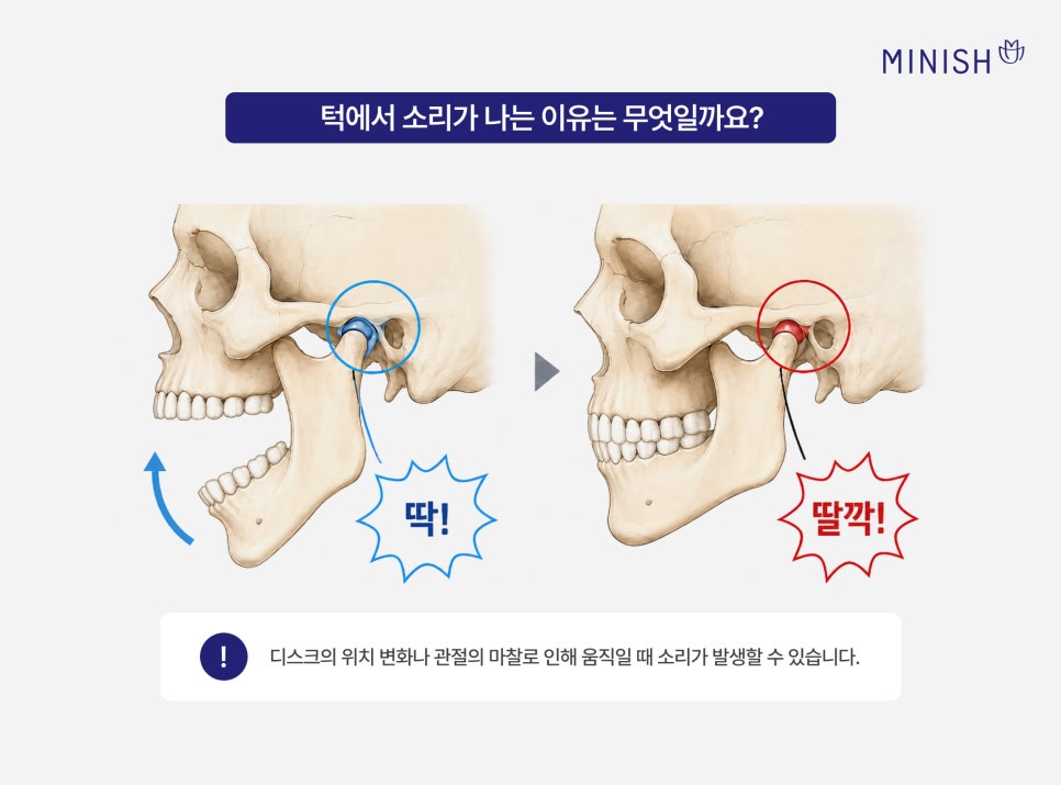 What Matters More Than the Price of a Bruxism Splint for Jaw Sounds: Criteria for Choosing a Temporomandibular Joint Dental Clinic image 2