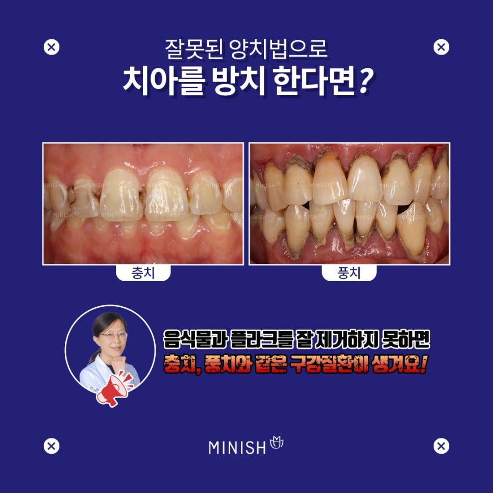 양치질 시간, 얼마나 오래 해야할까? 관련 이미지 3