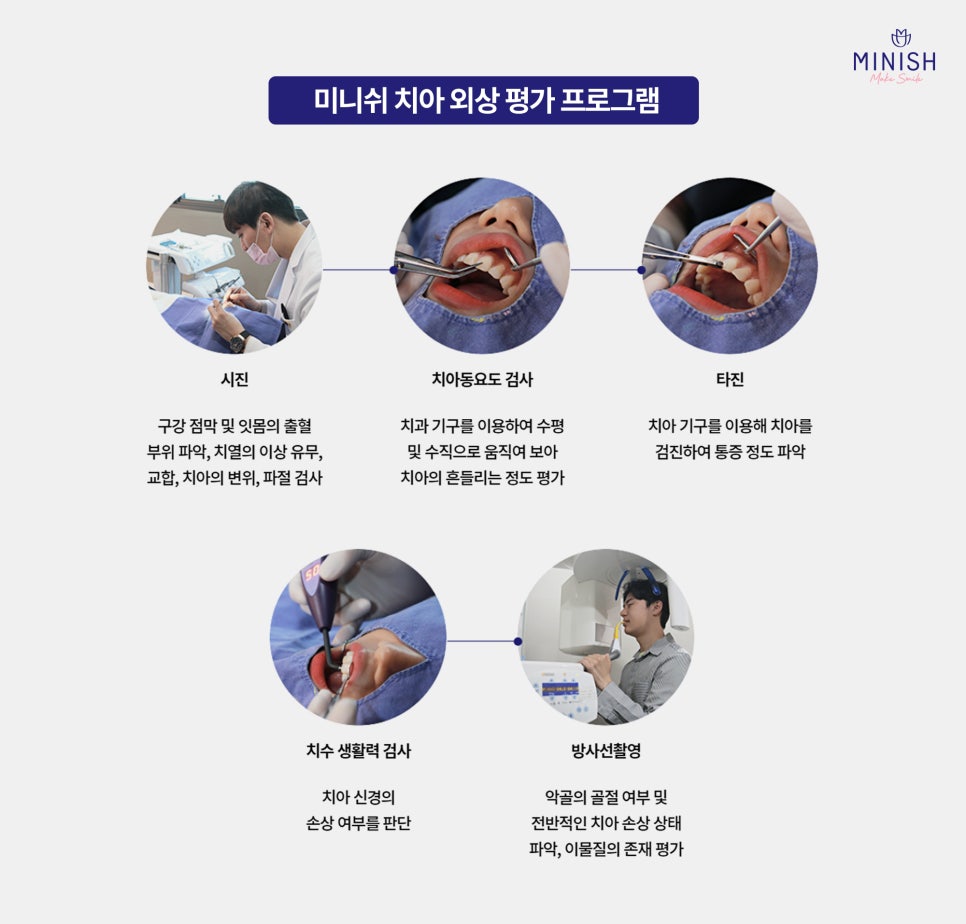 Sudden Tooth Breakage: Where Should You Go If You’re Not Sure? image 3