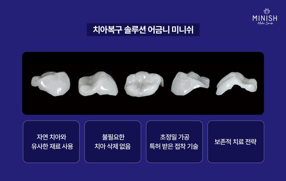 Don’t Ignore Molar Pain! Molar Minishe Can Restore Them Healthily image 5