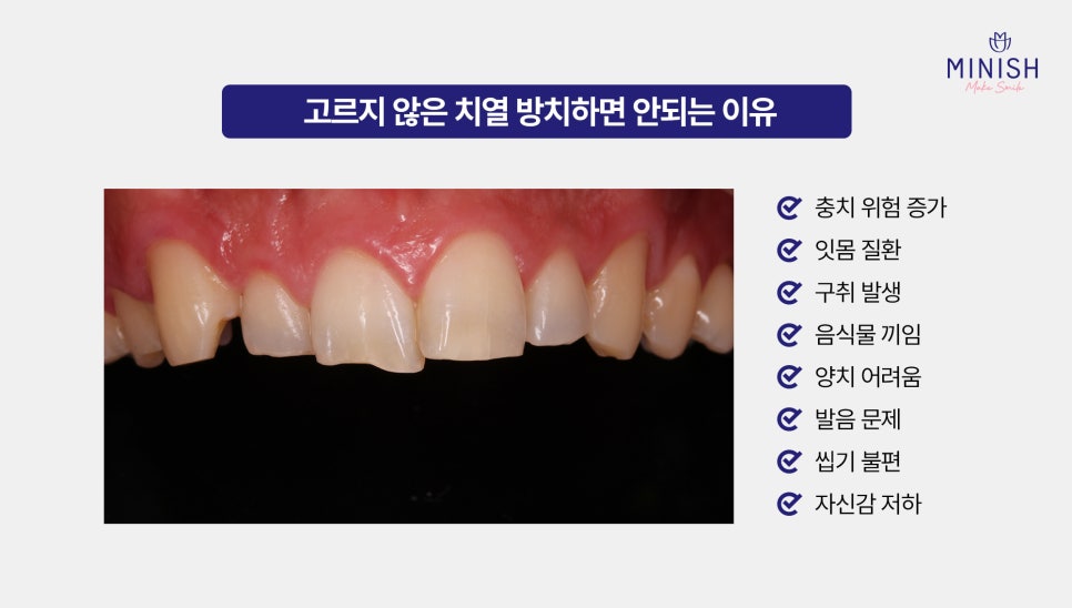A Complete Guide to Adult Orthodontic Types: Which Method Is Right for Me? image 2