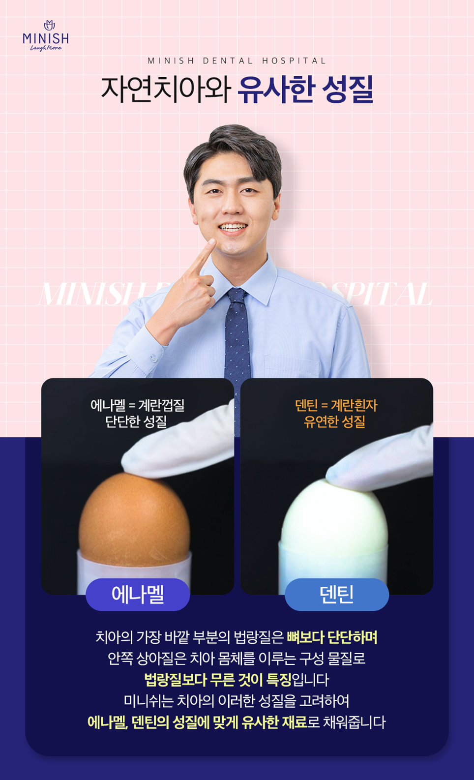어금니깨짐 방치 하지말고 어금니미니쉬로 개선해보시기 바랍니다. 관련 이미지 9