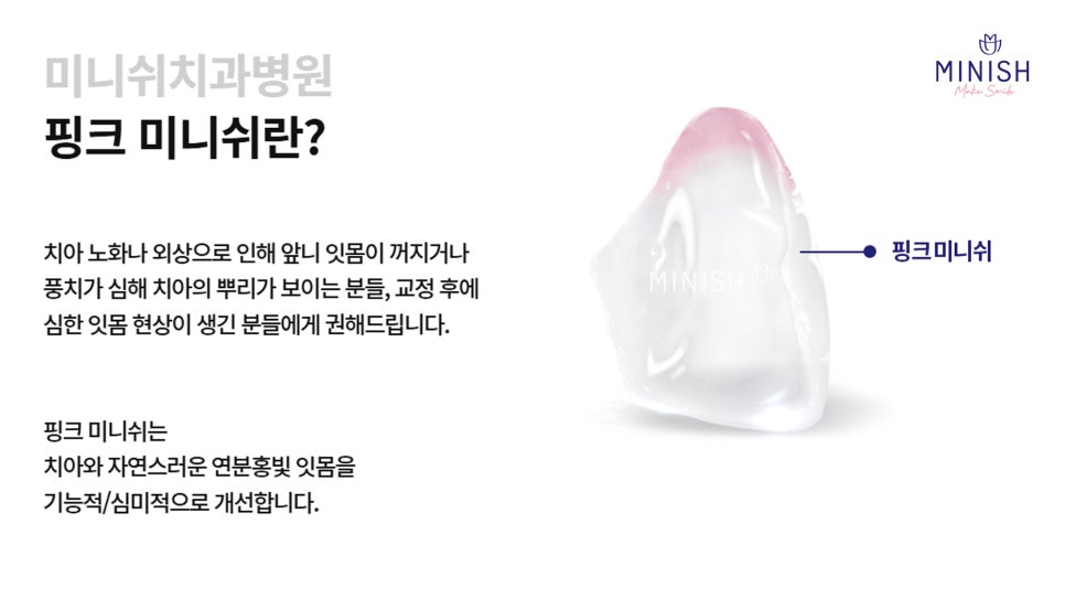 The front teeth I had worried about because of missing teeth, transformed healthily with MINISH image 7