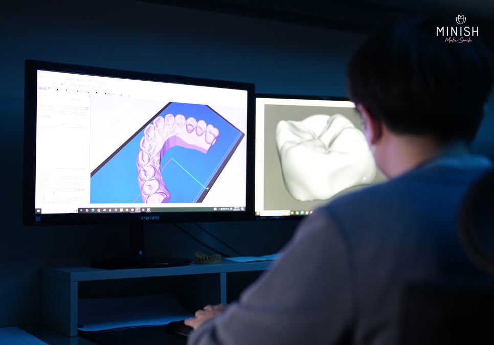 What Is the Technology Behind Minish’s Precise One-Day Restoration? It Comes from the Minish Dental Laboratory Research Center. image 12