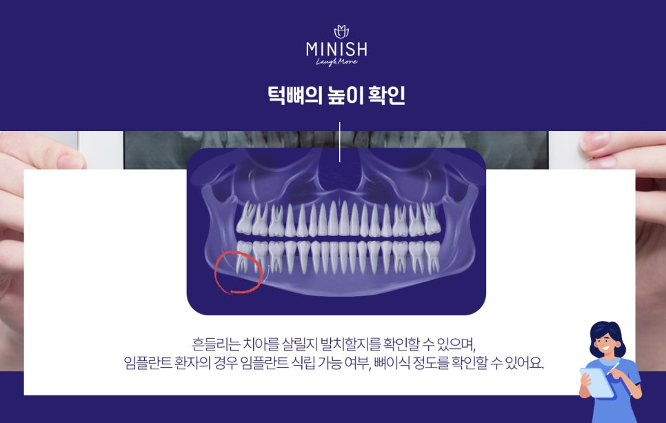 치과엑스레이는 내원할때마다 왜 촬영하는 걸까?😮 관련 이미지 4