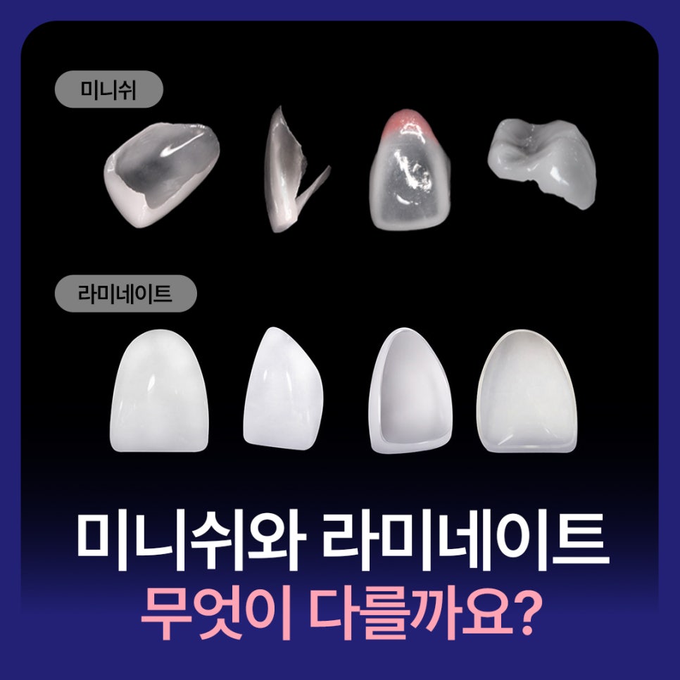 미니쉬와 라미네이트 차이점 총정리 관련 이미지 1