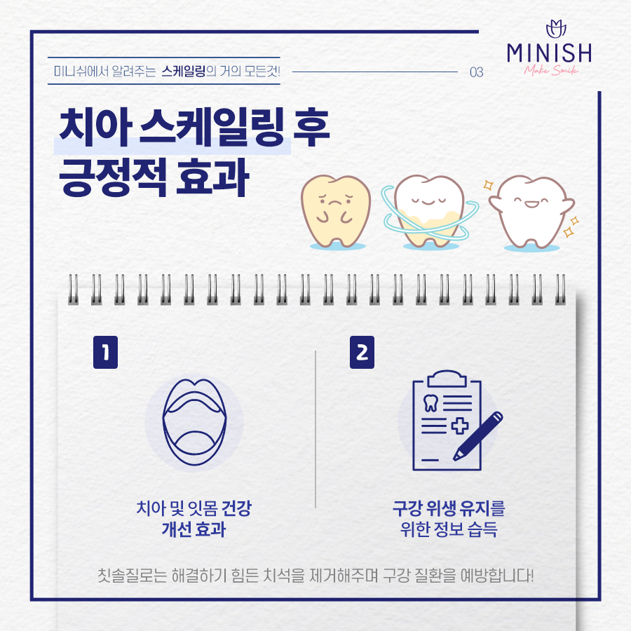치과 스케일링의 거의 모든 것 관련 이미지 4