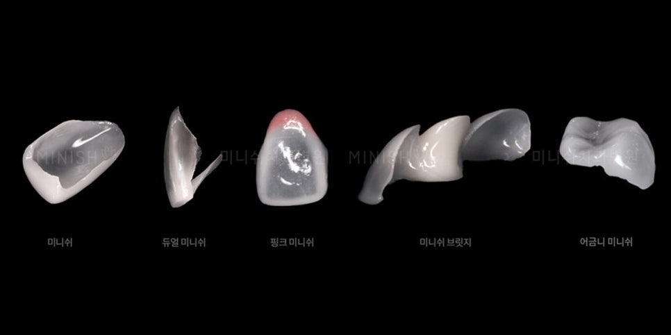 A 6-Year Minish Review from a Dentist, feat. Director Lee Jeong-eun image 9