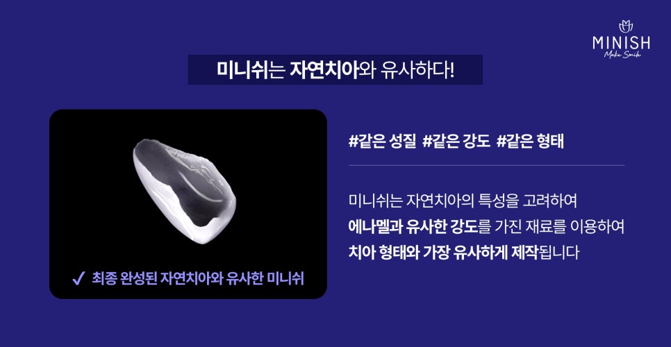 치아 브릿지 vs 미니쉬 브릿지 : 내 치아를 지키는 최적의 선택은? 관련 이미지 7