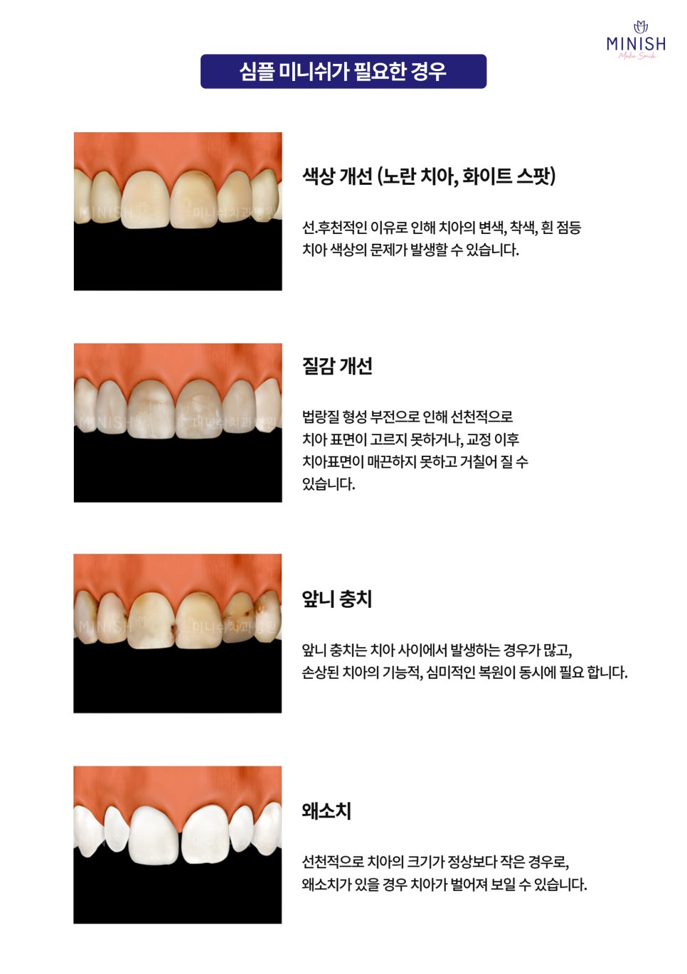A Complete Guide to the Minish Program That Fits My Teeth image 3