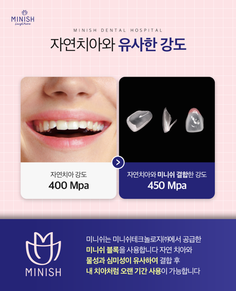 논현동치과 아름다운 미소와 함께 되찾은 자신감 관련 이미지 7