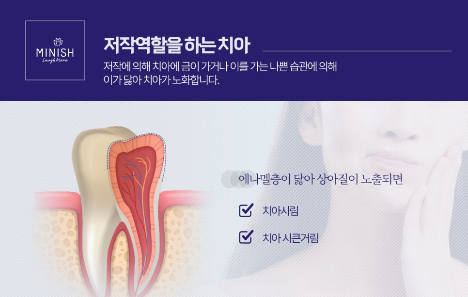 치아를 망치는 나쁜 습관? 치아 노화 막는 방법 관련 이미지 4