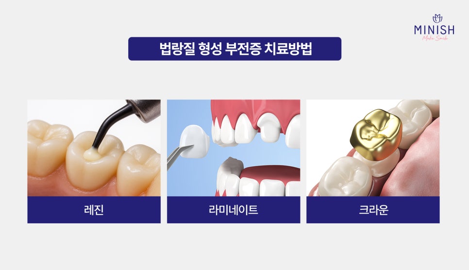 [Amelogenesis Imperfecta] If Your Teeth Wear Down and Break Easily, What Are the Treatment Options? Complete Guide image 4