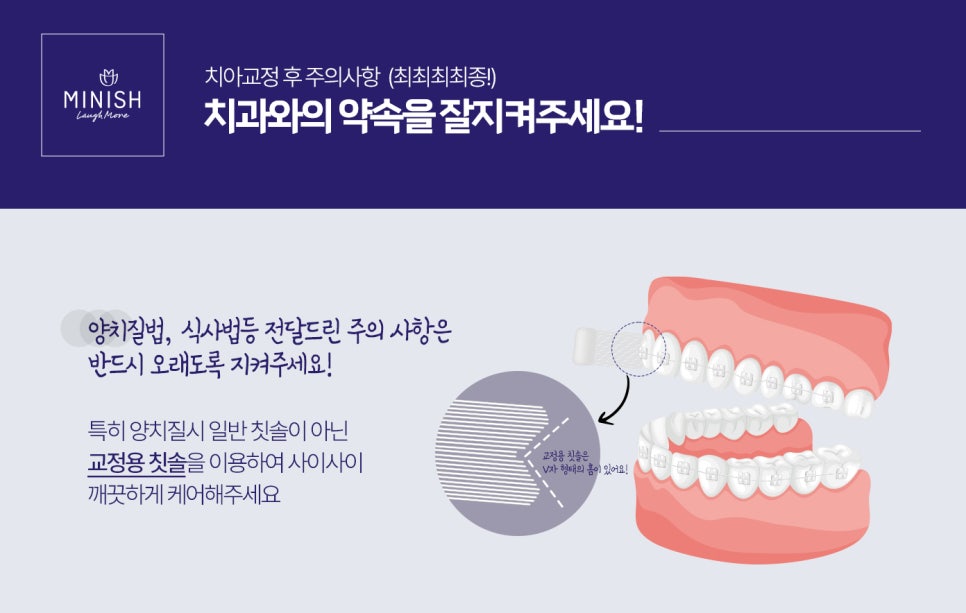 치아교정 과정 주의사항 관련 이미지 2