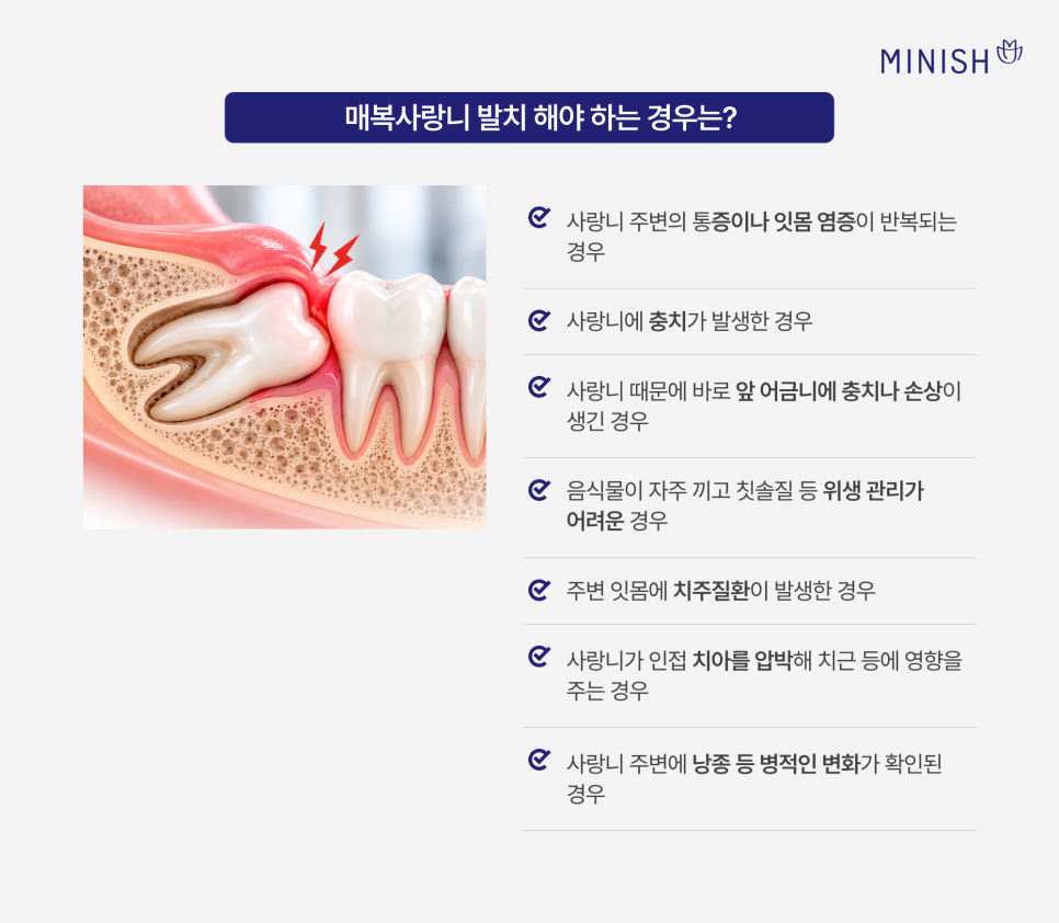 매복사랑니 통증, 발치 꼭 해야 하나요? 관련 이미지 4