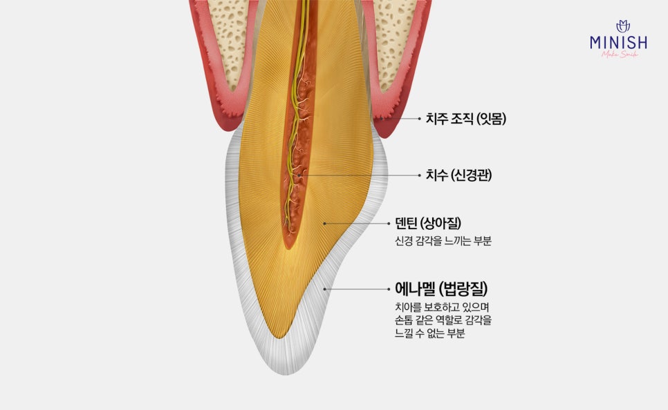 누런 치아? 치아변색 원인과 치료방법은? 관련 이미지 2