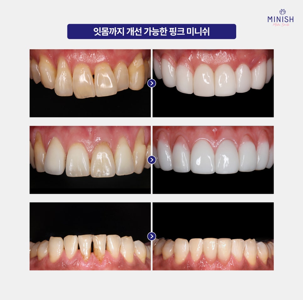 If This Sensitivity Continues, You May Be Developing Periodontal Disease image 5