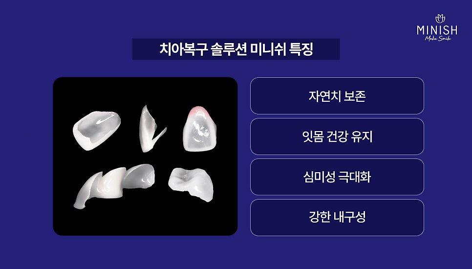 When Crown Retreatment Is Needed: The Tooth Restoration Solution Minish image 7