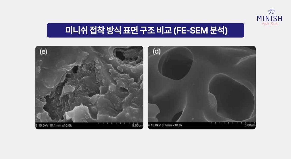 Minish Dental Hospital’s First Doctor Is Born, With Bonding Method Proven by Data: CEO Director Kwak Hae-sung image 2