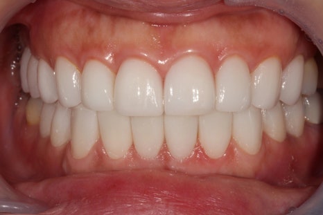 A 6-Year Minish Review from a Dentist, feat. Director Lee Jeong-eun image 3