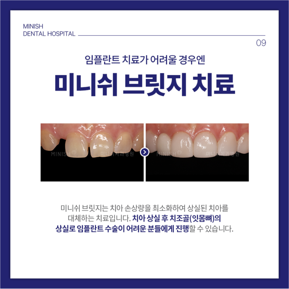 이빨 꿈 해몽 다 모여! +현실 치아 문제해결법 관련 이미지 5