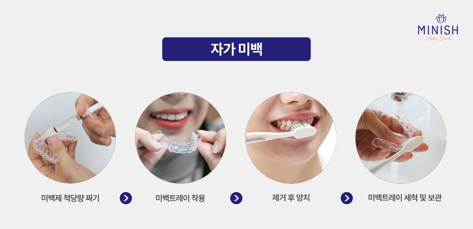 Yellow Teeth, From Causes to Solutions! Which Method Is Right for Me? image 5