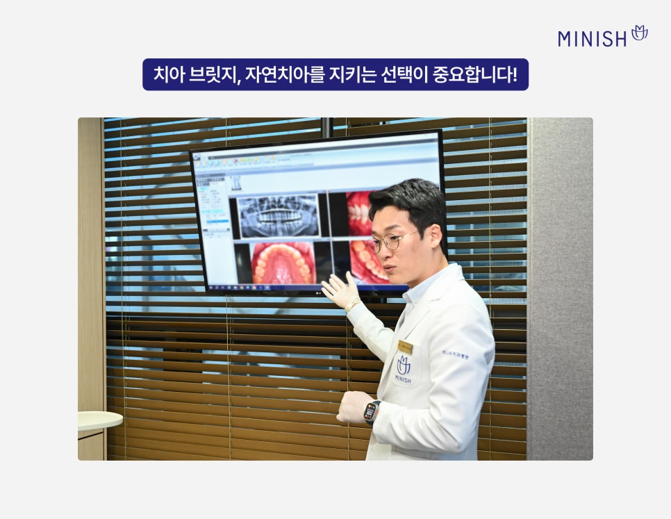 치아 브릿지, 자연치아를 보존하는 미니쉬 브릿지 관련 이미지 7