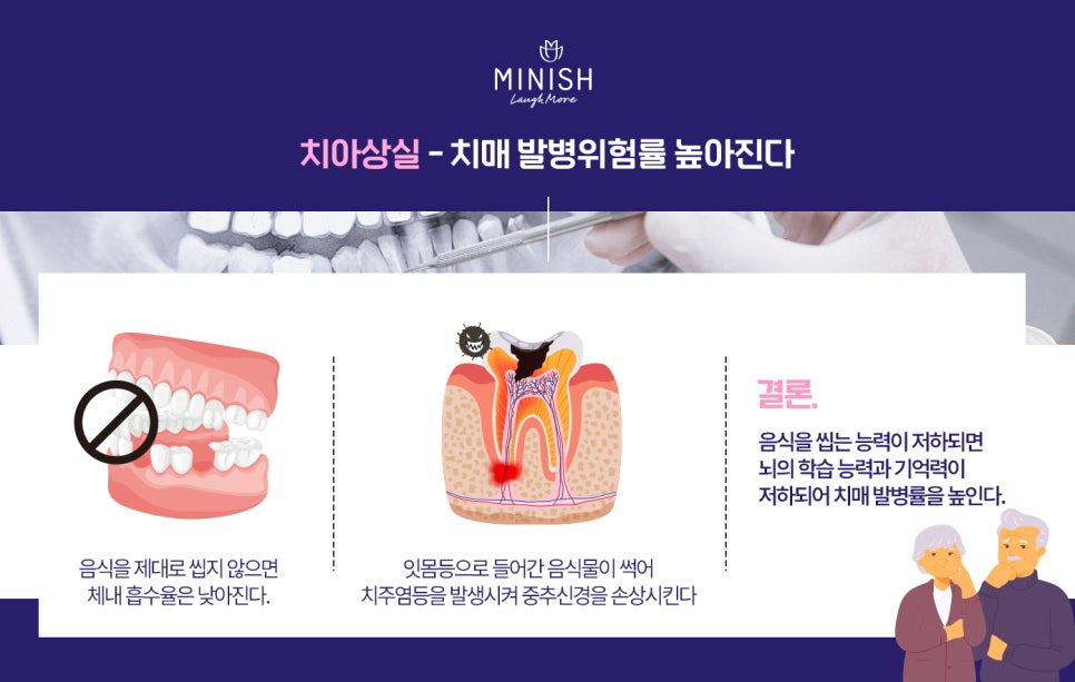 치아로 잘 씹지 못하면 치매 위험이 높아진다?! 관련 이미지 2