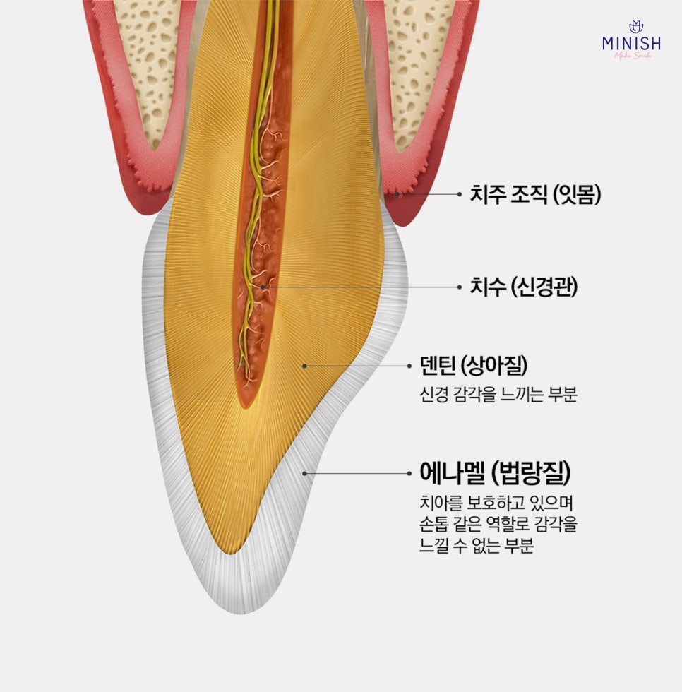If You Leave Tooth Wear Untreated, It Becomes Irreversible. What Is the Solution? image 2