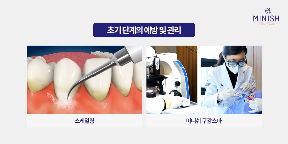 잇몸 부음, 방치하면 큰일! 원인과 치료법 알아보기 관련 이미지 6