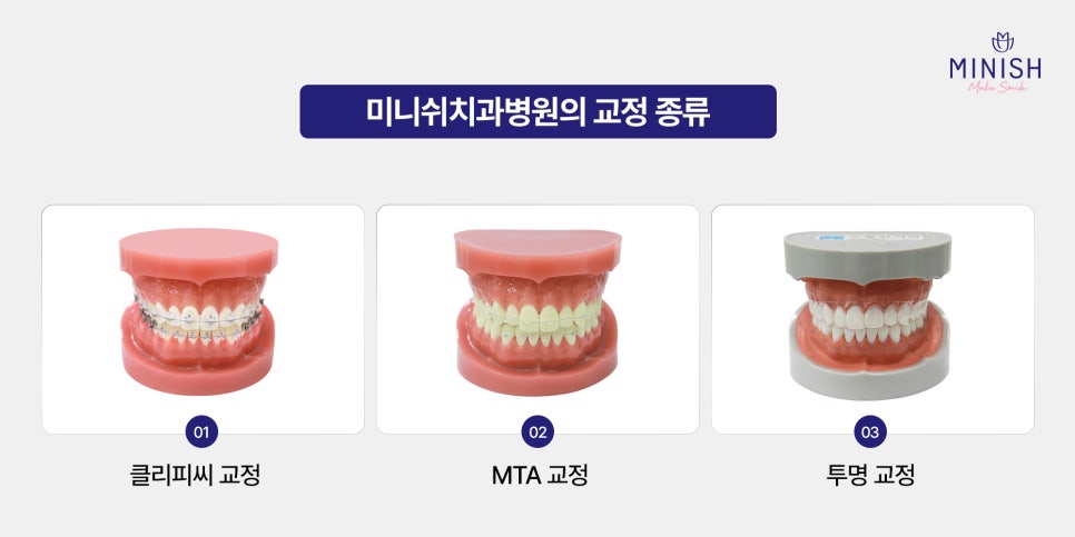 Types of Orthodontic Treatment at Minish Dental Hospital and How to Improve Aesthetics Too! image 3