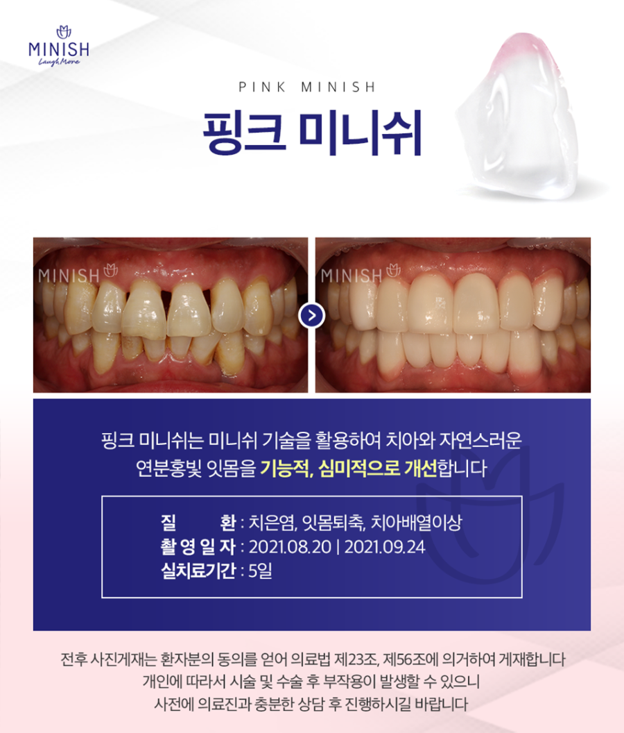 논현동치과 아름다운 미소와 함께 되찾은 자신감 관련 이미지 6