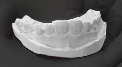 The Specialness of Minish: How to Restore Teeth in One Day! image 6