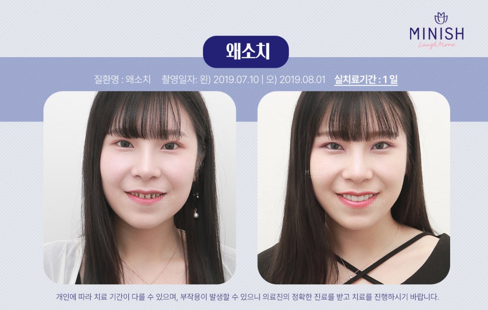 소중한 왜소치 지키는 법 관련 이미지 2