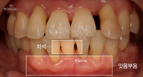 불행한 가정사를 딛고, 웃게 해준 관련 이미지 5