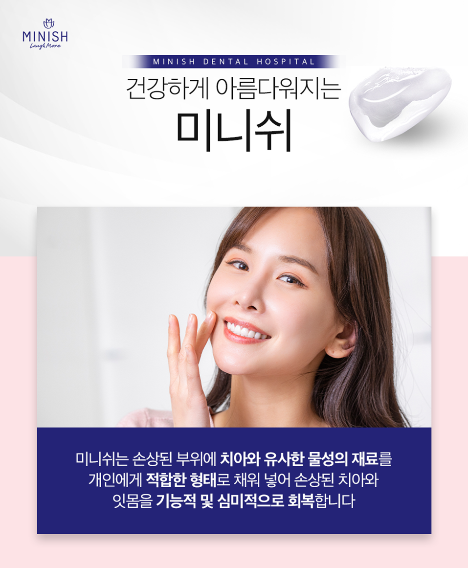 미니쉬솔루션 치아상실은 오래 방치하면 안되기에 관련 이미지 1