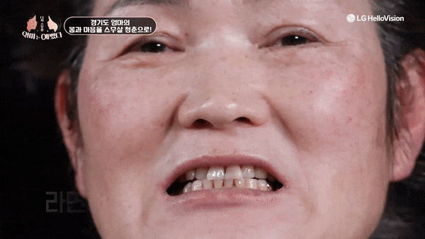 경기도엄마, 치아노화를 극복하다 [엄마는예뻤다] 관련 이미지 7