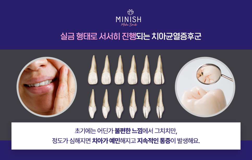 아이스 아메리카노 즐겨 마시면 치아가 안 좋아질까? 관련 이미지 4