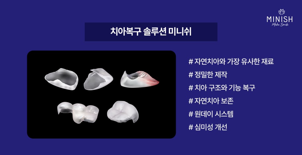 Gummy Smile: Why the Gums Show So Much When You Smile and How to Improve It image 5
