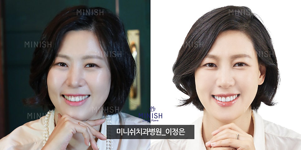 A 6-Year Minish Review from a Dentist, feat. Director Lee Jeong-eun image 1