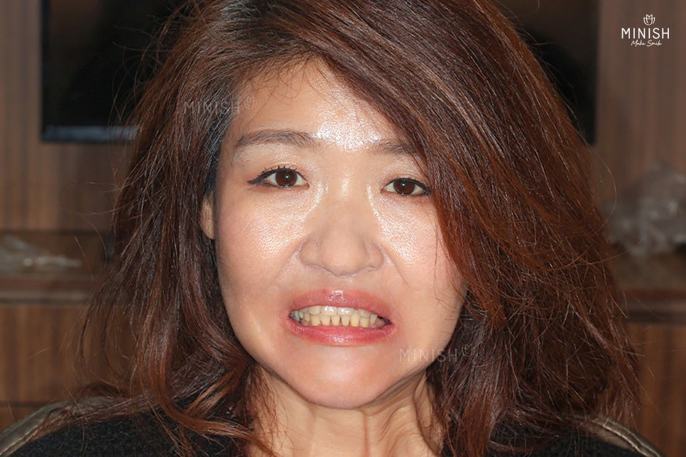Are you wondering how to restore gums damaged by gum disease? image 3