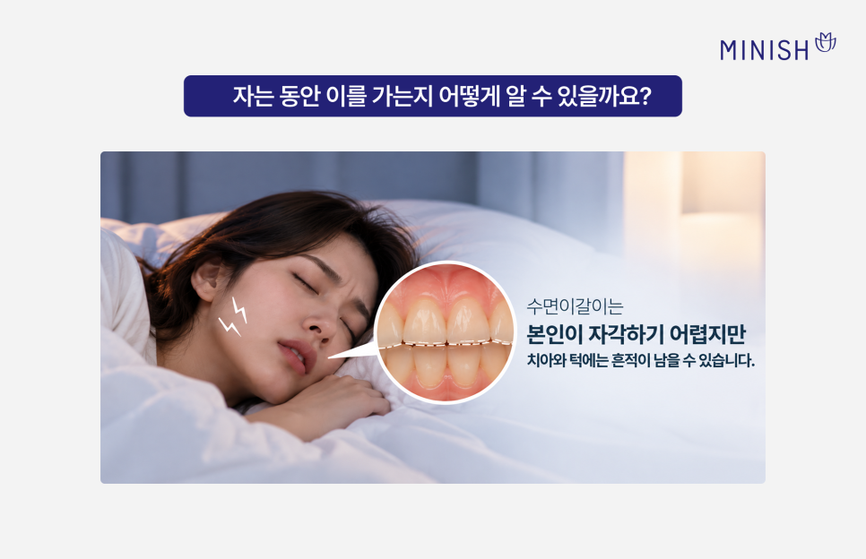 수면이갈이 원인과 증상, 이갈이 치료와 스플린트가 필요한 경우 관련 이미지 3
