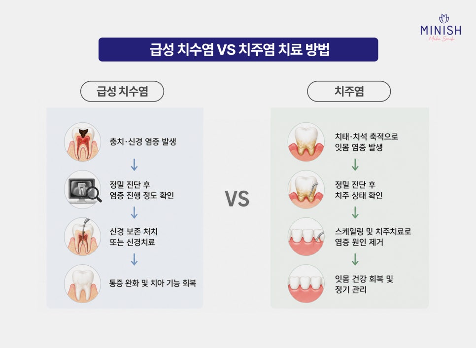 급성 치수염 VS 치주염 원인, 증상, 치료 방법까지 관련 이미지 7